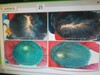 20대초반 남성탈모 3개월 후기.