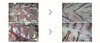 두부건선 10개월관리 (주 1회)