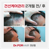 안티에이징 케어 2개월 전/ 후