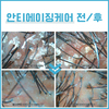 안티에이징 케어 전/ 후