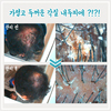 안티에이징케어  5개월 