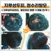지루성두피로 인한 정수리탈모 관리 전/ 후