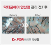 20대여성 컨트롤케어 관리 전/후