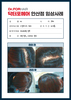 여성탈모관리 전/후