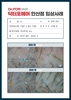 40대 남성 정수리 탈모 5개월 관리 후
