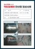 가르마 탈모 관리 5개월
